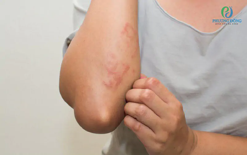 Dấu hiệu suy thận - Khó tập trung, đau đầu