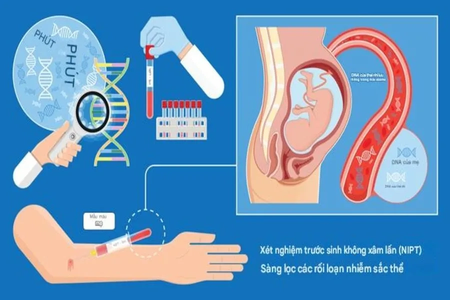 Phương thức phân tích vật chất di truyền xét nghiệm NIPT