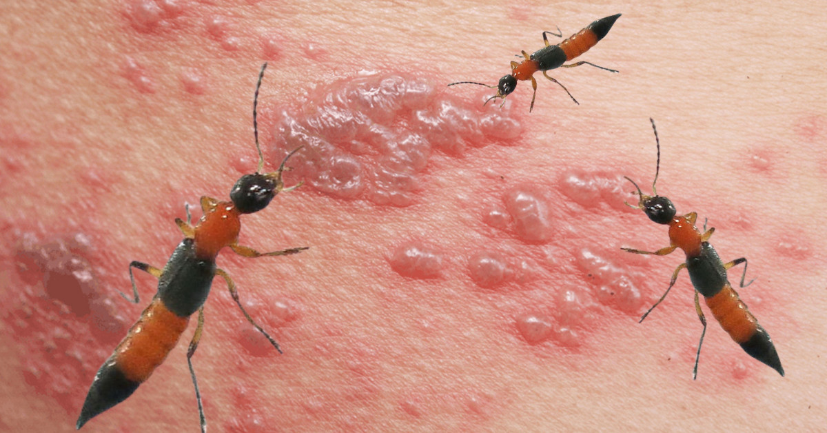 Giải pháp bảo vệ không gian sống khỏi sự tấn công của côn trùng