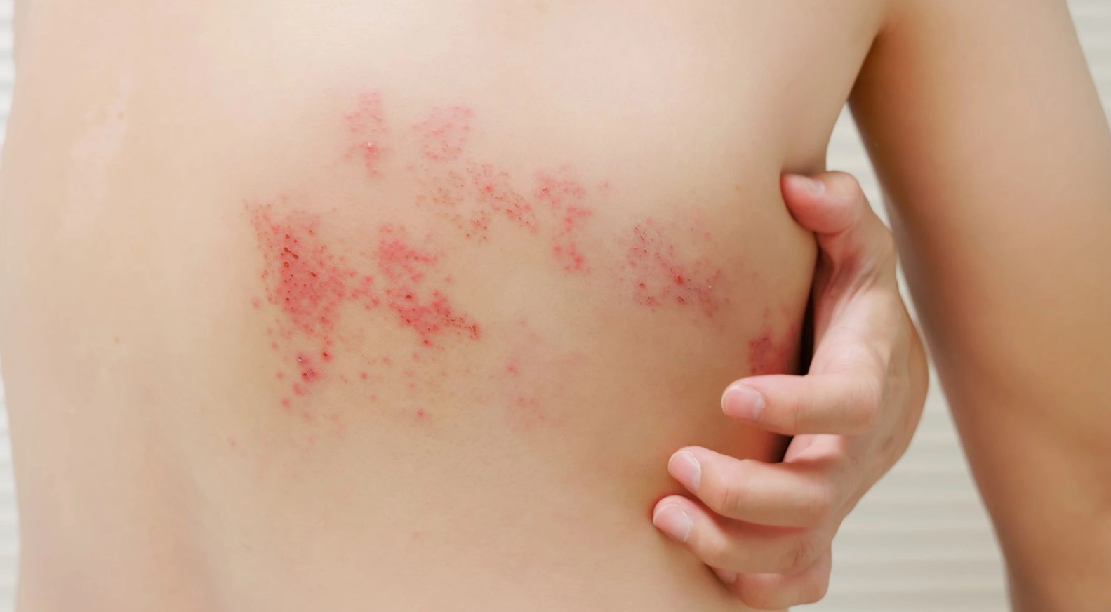 Dấu hiệu lâm sàng phổ biến của bệnh