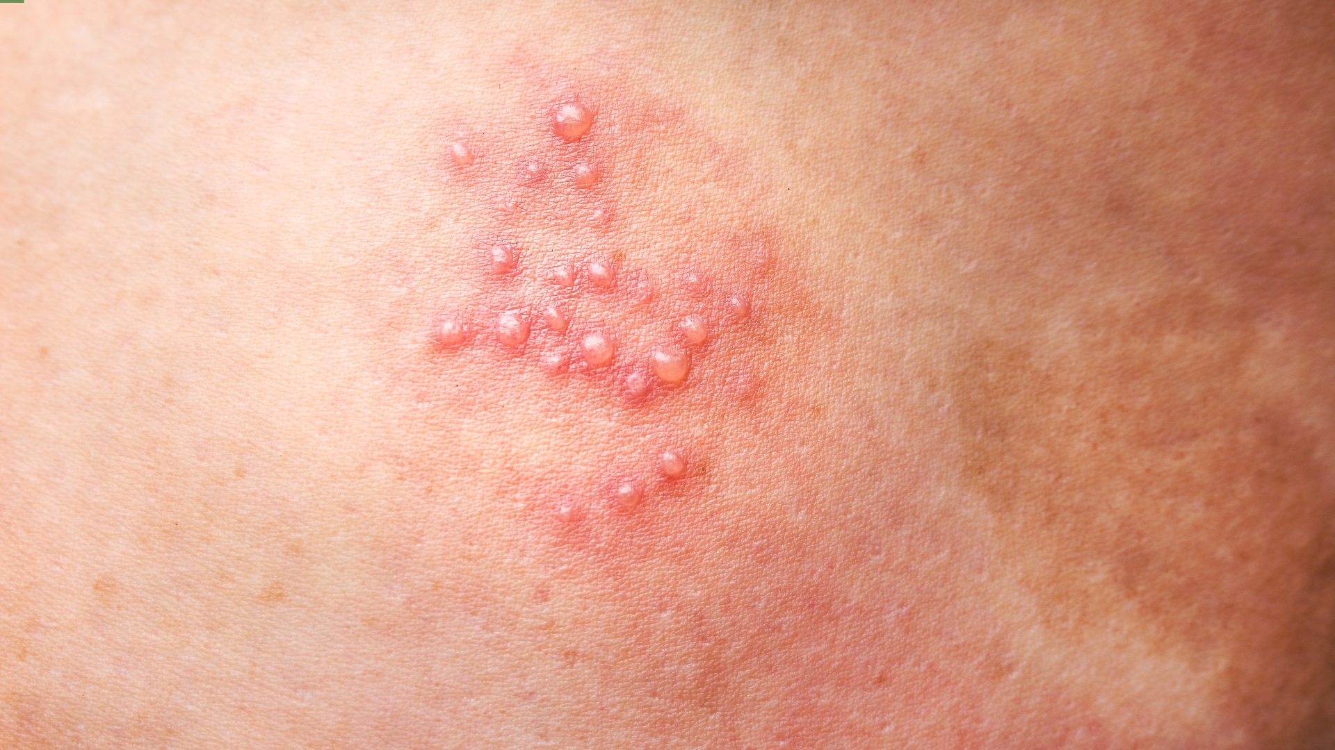 Phương pháp khắc phục triệu chứng bệnh lý