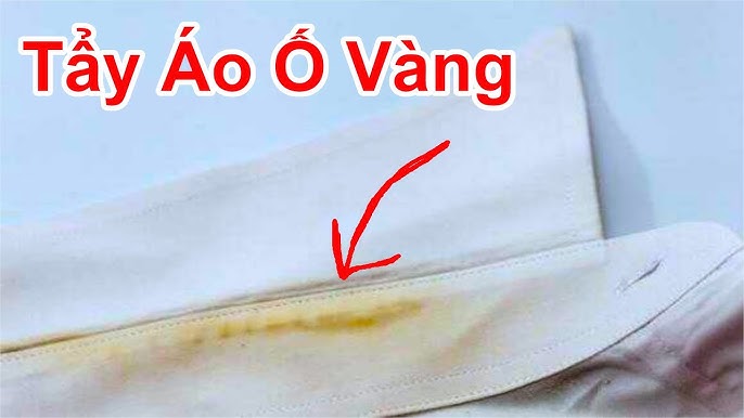 Cách tẩy vết ố vàng trên áo trắng - Nhìn đúng kiểu ố để xử lý nhanh mà an toàn