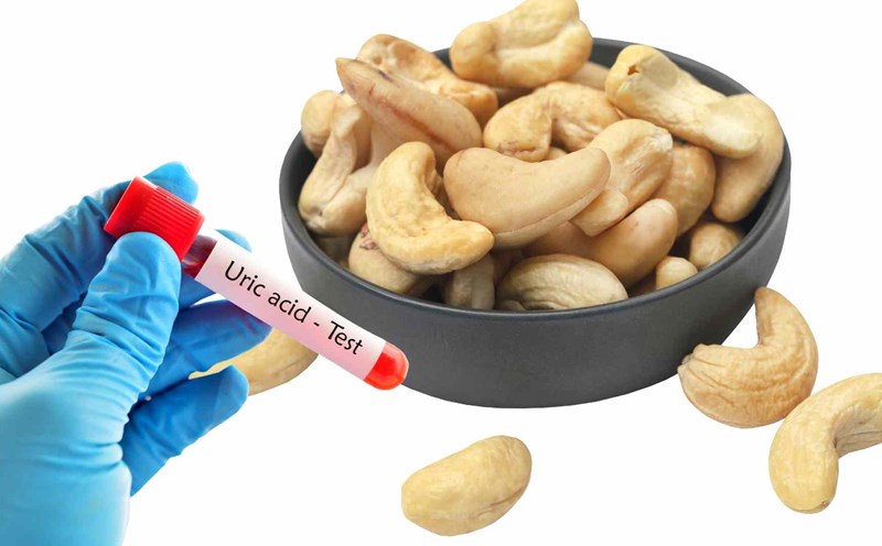 Hạt điều - Nguồn gốc và đặc điểm dễ nhận biết Hạt điều - Nguồn gốc và đặc điểm dễ nhận biết